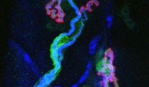 Confocal image of mature neuromuscular junctions.