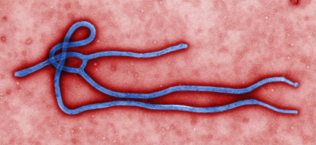 Ebola.