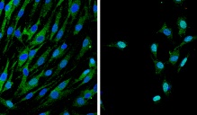 Myelination image of Yap and Taz proteins.