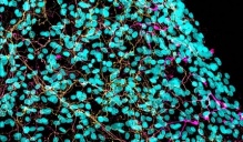 This image shows axons in vitro 24 hours after injury. The presence of Schwann cells (nuclei in cyan) helped maintain the integrity of axons (in magenta and yellow). Image credit: Elisabetta Babetto, HJKRI.