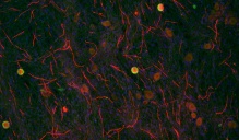 Oligodendrocytes with cortical neurons.