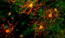 cell culture of oligodendrocytes interacting with neurons during myelination process.